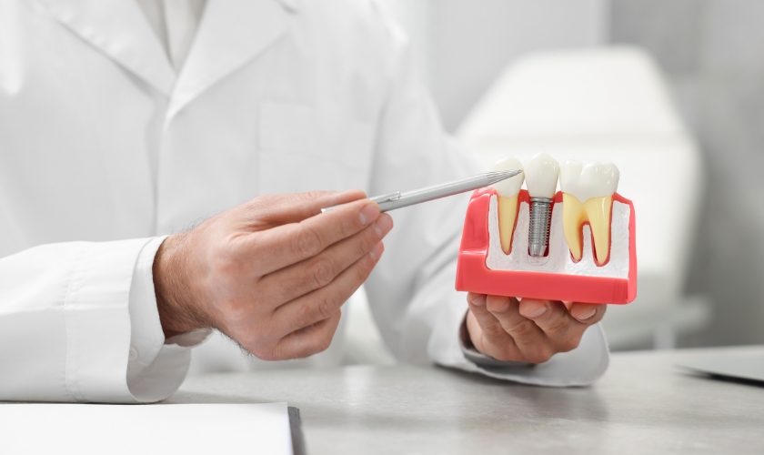 essential tips for dental implant care to ensure a radiant smile